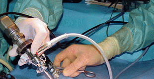 Átadták az új endoszkópos műtőt