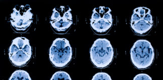 Magas szakmai elismerés a CT egységnek