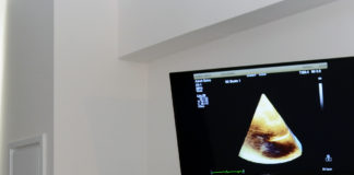Digitális szívultrahang-labor került átadásra a Kardiológiai Osztályon